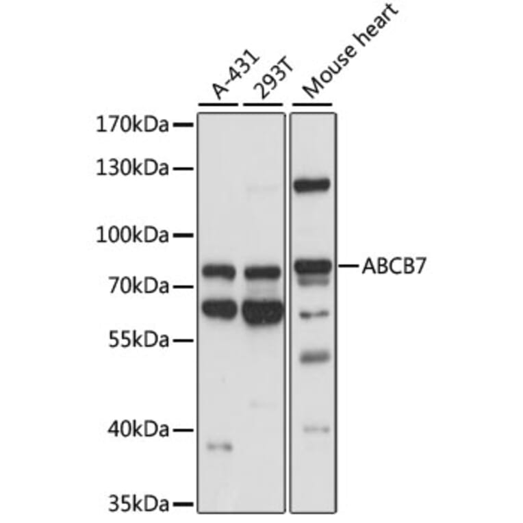 Western Blot - Anti-ABCB7 Antibody (A91323) - Antibodies.com