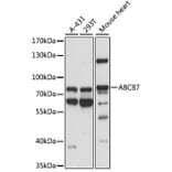 Western Blot - Anti-ABCB7 Antibody (A91323) - Antibodies.com
