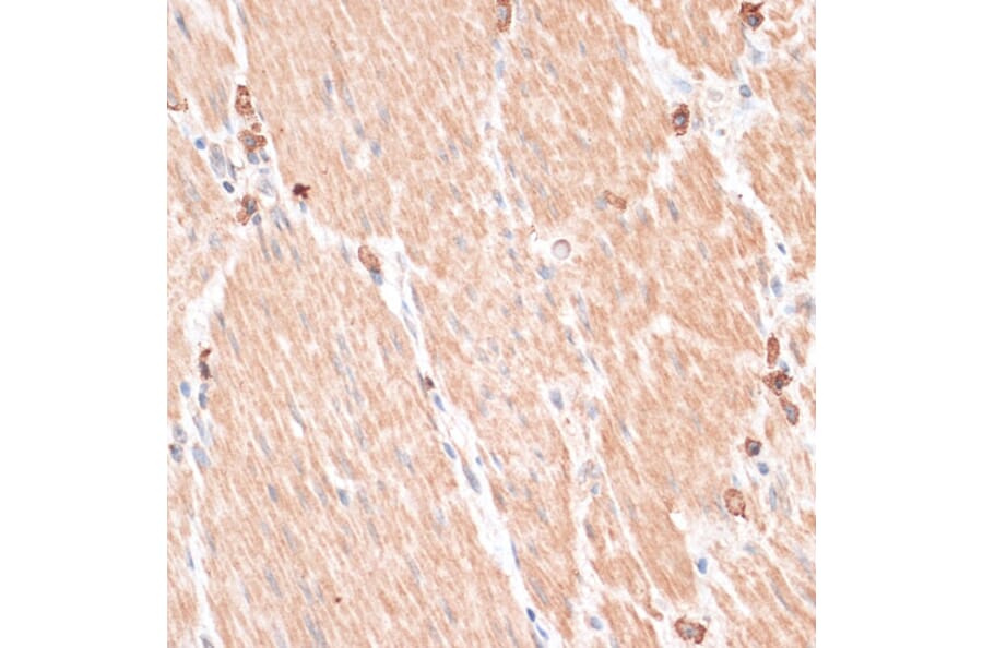 Immunohistochemistry - Anti-ABCB7 Antibody (A91323) - Antibodies.com