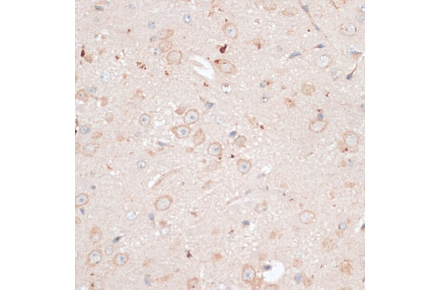 Immunohistochemistry - Anti-ABCB7 Antibody (A91323) - Antibodies.com