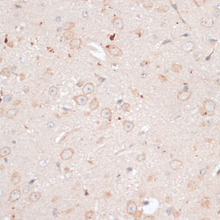 Immunohistochemistry - Anti-ABCB7 Antibody (A91323) - Antibodies.com