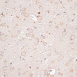 Immunohistochemistry - Anti-ABCB7 Antibody (A91323) - Antibodies.com