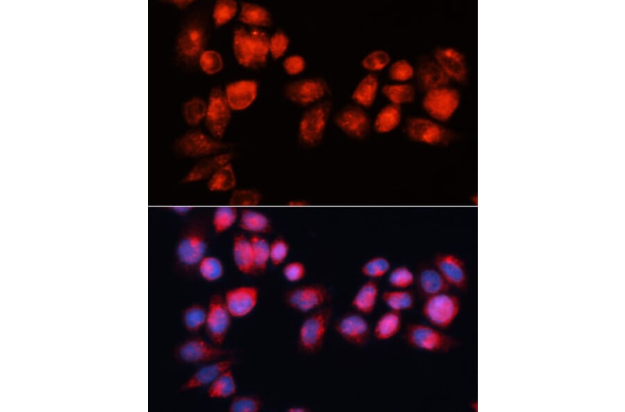 Immunofluorescence - Anti-ABCB7 Antibody (A91323) - Antibodies.com