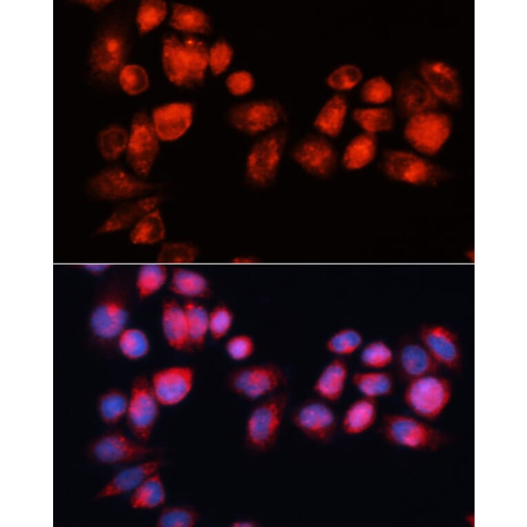 Immunofluorescence - Anti-ABCB7 Antibody (A91323) - Antibodies.com