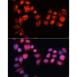Immunofluorescence - Anti-ABCB7 Antibody (A91323) - Antibodies.com
