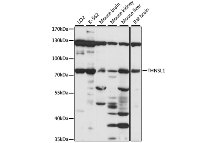 Western Blot - Anti-THNSL1 Antibody (A91324) - Antibodies.com