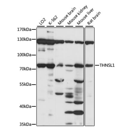 Western Blot - Anti-THNSL1 Antibody (A91324) - Antibodies.com