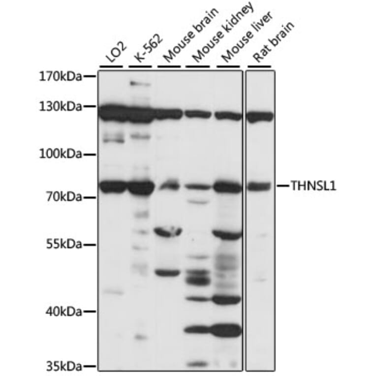 Western Blot - Anti-THNSL1 Antibody (A91324) - Antibodies.com