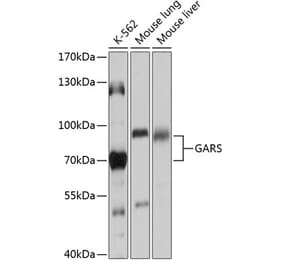 Western Blot - Anti-GARS Antibody (A91325) - Antibodies.com