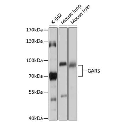 Western Blot - Anti-GARS Antibody (A91325) - Antibodies.com