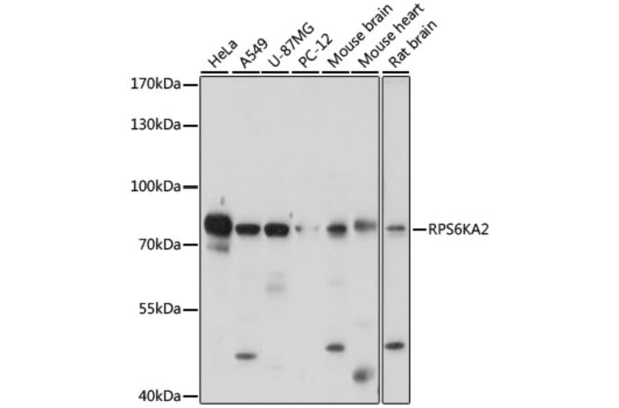 Western Blot - Anti-RSK3 Antibody (A91326) - Antibodies.com