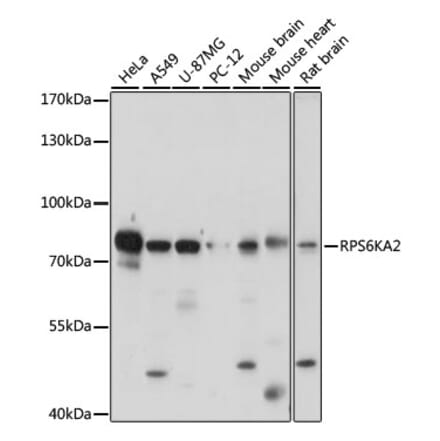 Western Blot - Anti-RSK3 Antibody (A91326) - Antibodies.com