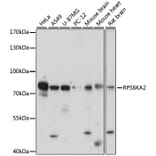 Western Blot - Anti-RSK3 Antibody (A91326) - Antibodies.com