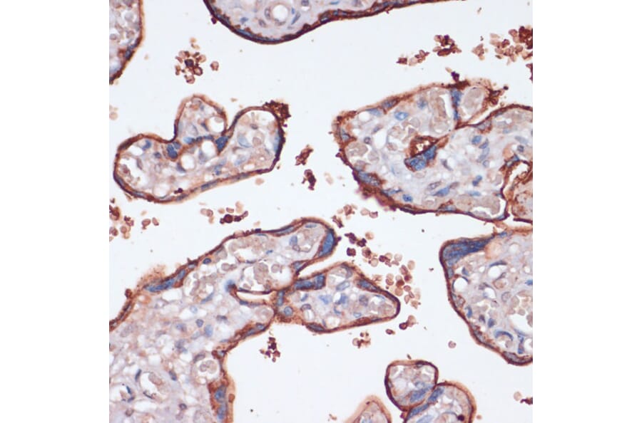 Immunohistochemistry - Anti-RSK3 Antibody (A91326) - Antibodies.com