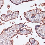 Immunohistochemistry - Anti-RSK3 Antibody (A91326) - Antibodies.com