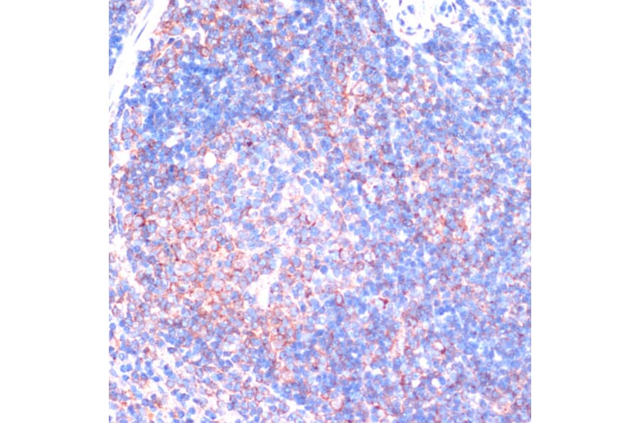 Immunohistochemistry - Anti-RSK3 Antibody (A91326) - Antibodies.com