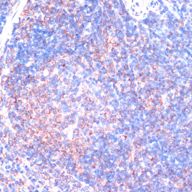 Immunohistochemistry - Anti-RSK3 Antibody (A91326) - Antibodies.com
