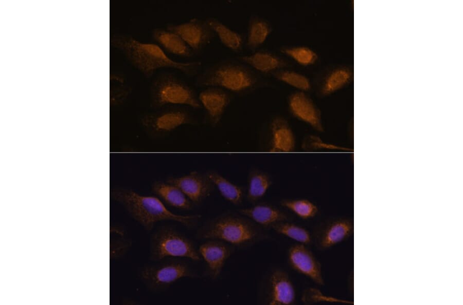 Immunofluorescence - Anti-RSK3 Antibody (A91326) - Antibodies.com