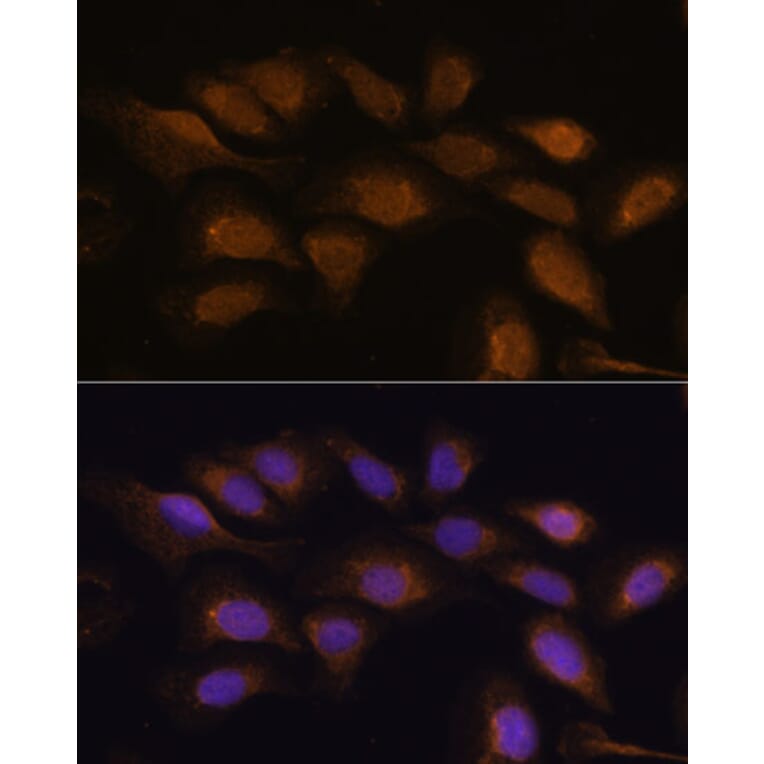 Immunofluorescence - Anti-RSK3 Antibody (A91326) - Antibodies.com