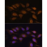 Immunofluorescence - Anti-RSK3 Antibody (A91326) - Antibodies.com