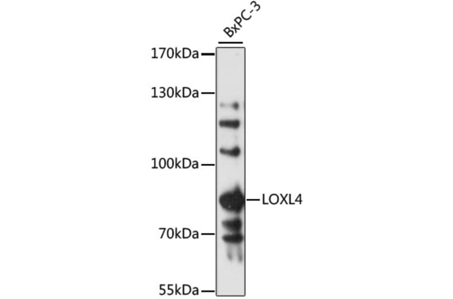 Western Blot - Anti-LOXL4 Antibody (A13131) - Antibodies.com