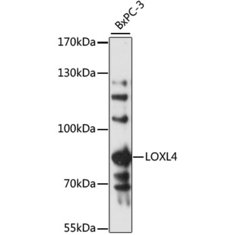 Western Blot - Anti-LOXL4 Antibody (A13131) - Antibodies.com