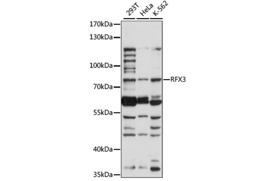 Western Blot - Anti-RFX3 Antibody (A91330) - Antibodies.com