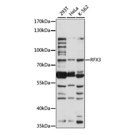 Western Blot - Anti-RFX3 Antibody (A91330) - Antibodies.com