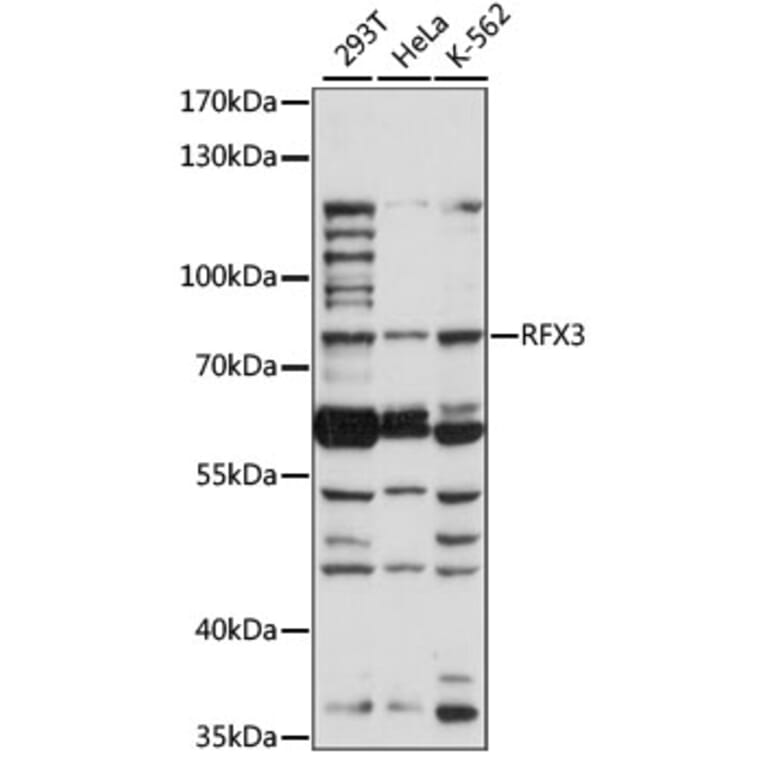 Western Blot - Anti-RFX3 Antibody (A91330) - Antibodies.com