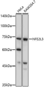 Western blot analysis of extracts of various cell lines, using Anti-NFE2L3 Antibody (A15761) at 1:1,000 dilution.
Secondary antibody: Goat Anti-Rabbit IgG (H+L) (HRP) (AS014) at 1:10,000 dilution.
Lysates / proteins: 25µg per lane.
Blocking buffer: 3% non-fat dry milk in TBST.
Detection: ECL Basic Kit (RM00020).
Exposure time: 10s.