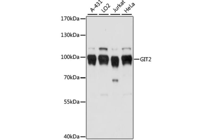 Western Blot - Anti-GIT2 Antibody (A91332) - Antibodies.com