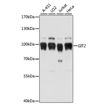 Western Blot - Anti-GIT2 Antibody (A91332) - Antibodies.com
