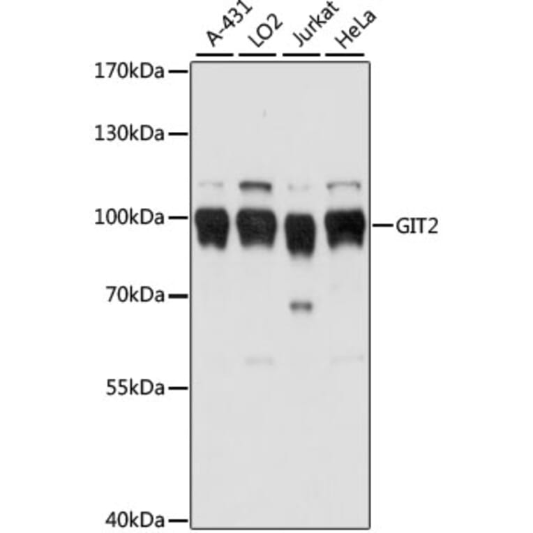 Western Blot - Anti-GIT2 Antibody (A91332) - Antibodies.com