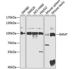 Western Blot - Anti-Mitofilin Antibody (A91333) - Antibodies.com