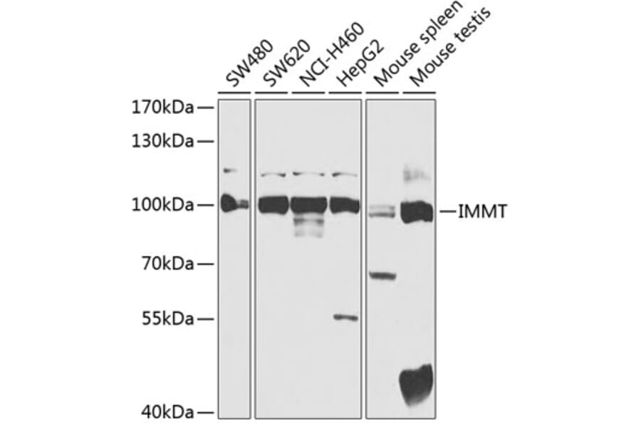 Western Blot - Anti-Mitofilin Antibody (A91333) - Antibodies.com