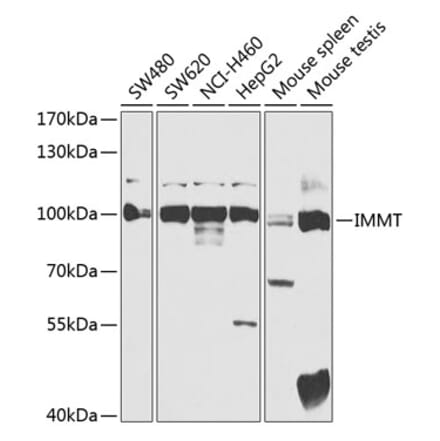 Western Blot - Anti-Mitofilin Antibody (A91333) - Antibodies.com