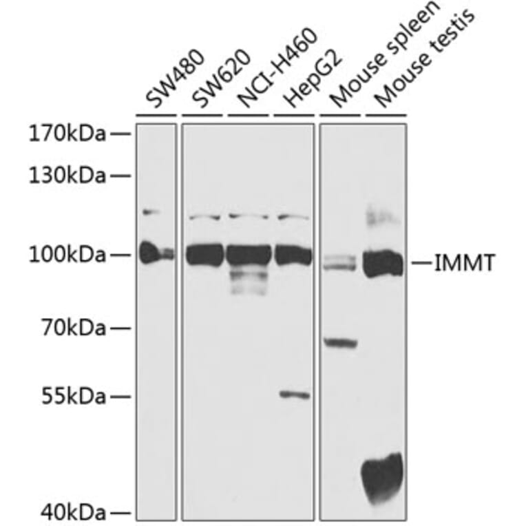 Western Blot - Anti-Mitofilin Antibody (A91333) - Antibodies.com