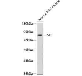 Western Blot - Anti-SKI Antibody (A91334) - Antibodies.com