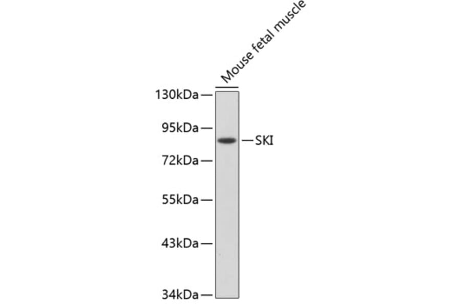 Western Blot - Anti-SKI Antibody (A91334) - Antibodies.com