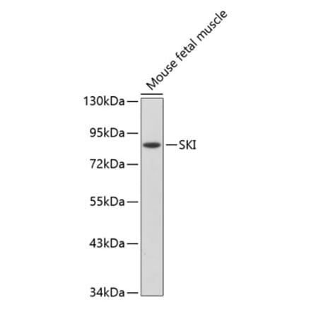 Western Blot - Anti-SKI Antibody (A91334) - Antibodies.com