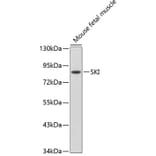 Western Blot - Anti-SKI Antibody (A91334) - Antibodies.com