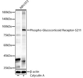 Western Blot - Anti-Glucocorticoid Receptor (phospho Ser211) Antibody (A91335) - Antibodies.com