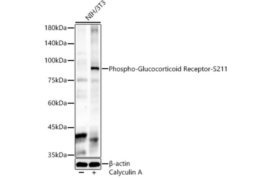 Western Blot - Anti-Glucocorticoid Receptor (phospho Ser211) Antibody (A91335) - Antibodies.com