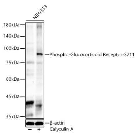 Western Blot - Anti-Glucocorticoid Receptor (phospho Ser211) Antibody (A91335) - Antibodies.com