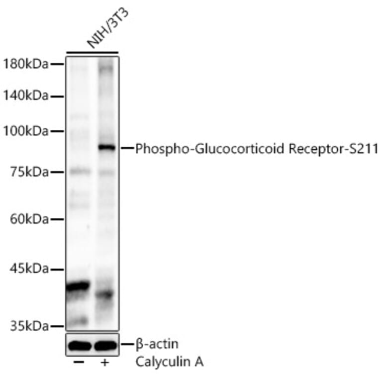 Western Blot - Anti-Glucocorticoid Receptor (phospho Ser211) Antibody (A91335) - Antibodies.com