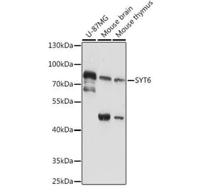 Western Blot - Anti-SYT6 Antibody (A91336) - Antibodies.com