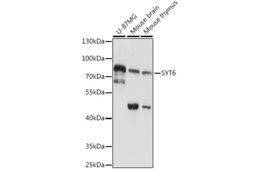 Western Blot - Anti-SYT6 Antibody (A91336) - Antibodies.com