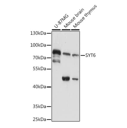 Western Blot - Anti-SYT6 Antibody (A91336) - Antibodies.com