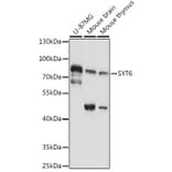 Western Blot - Anti-SYT6 Antibody (A91336) - Antibodies.com