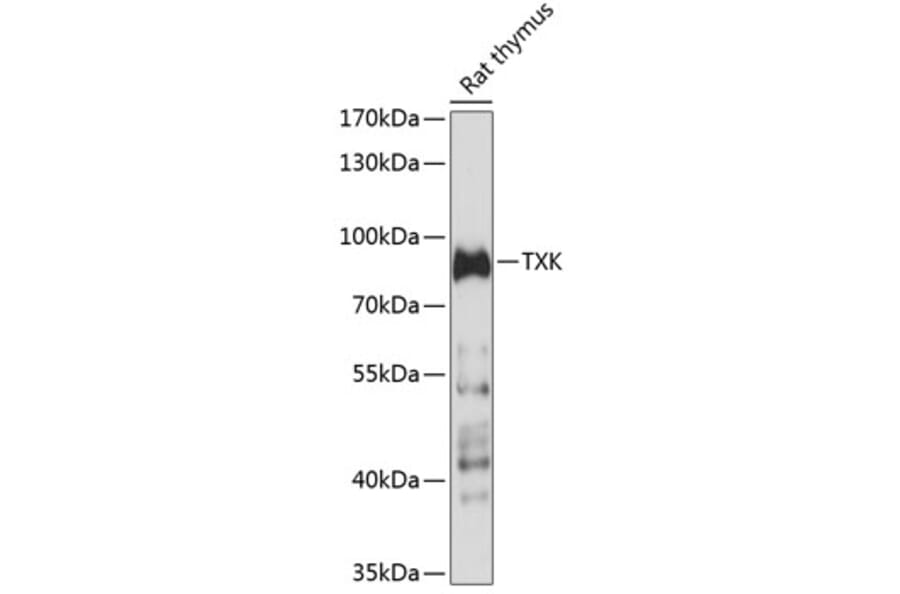 Western Blot - Anti-TXK/RLK Antibody (A91337) - Antibodies.com